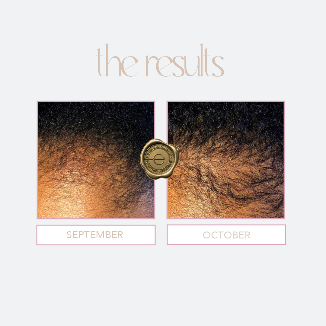 Flourishing Hair Oil